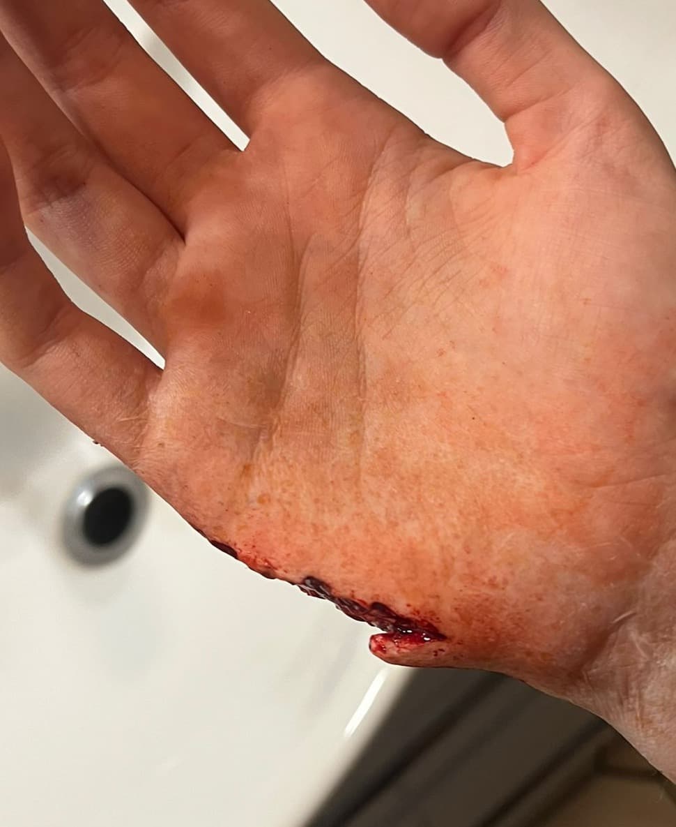 Realistische Stichwunde