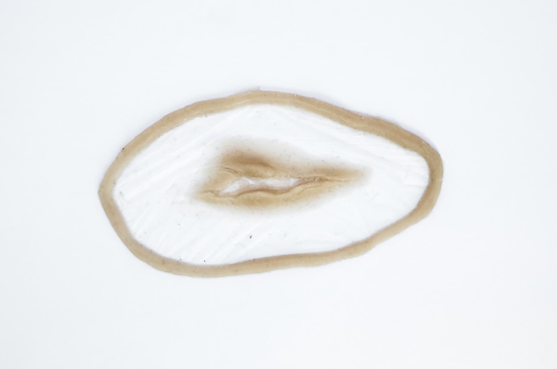 Tiefe Stichverletzung