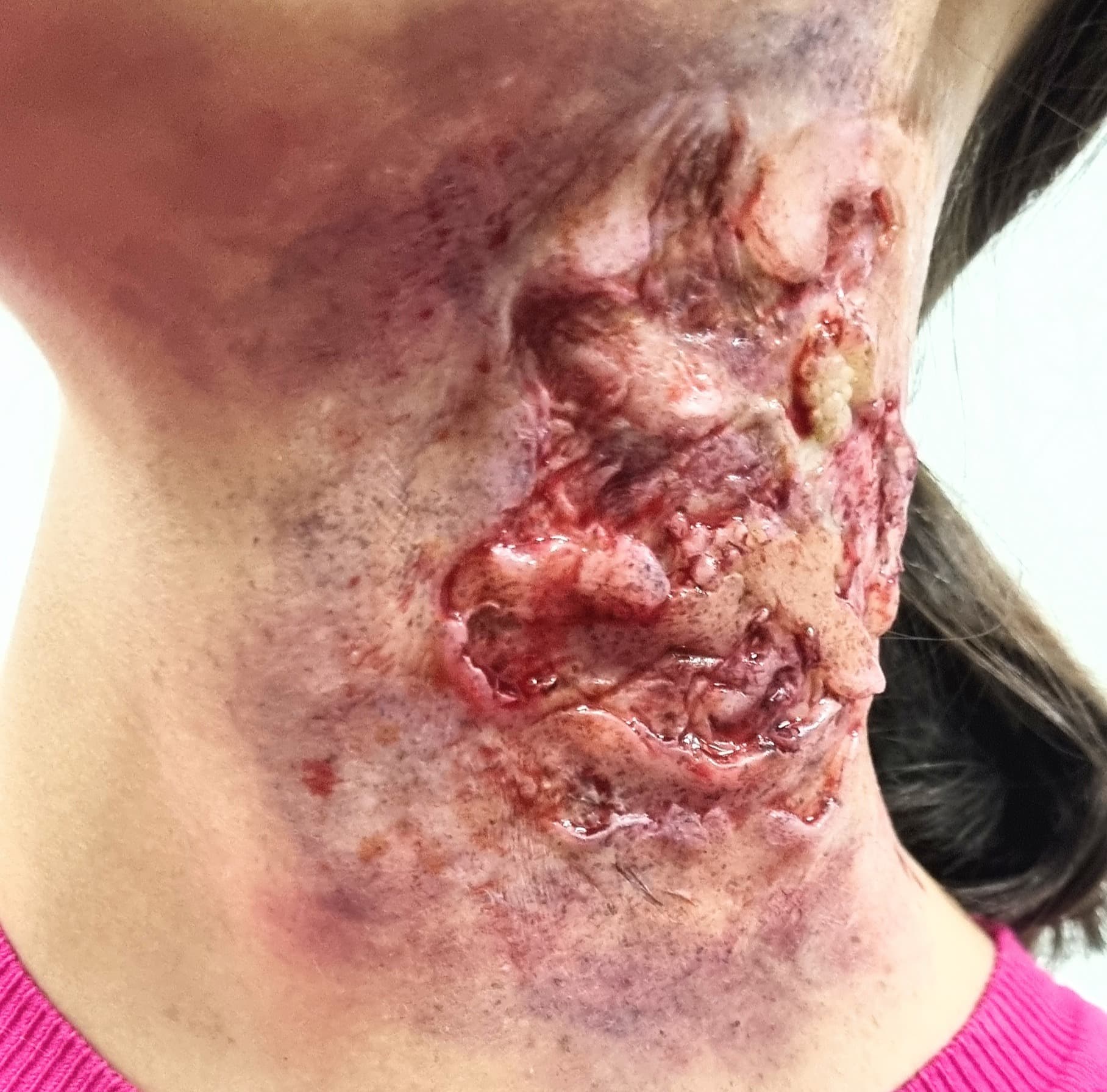 Mehr als nur eine Prosthetic